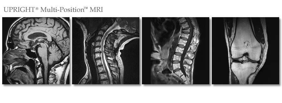Stand-Up MRI of SW Florida